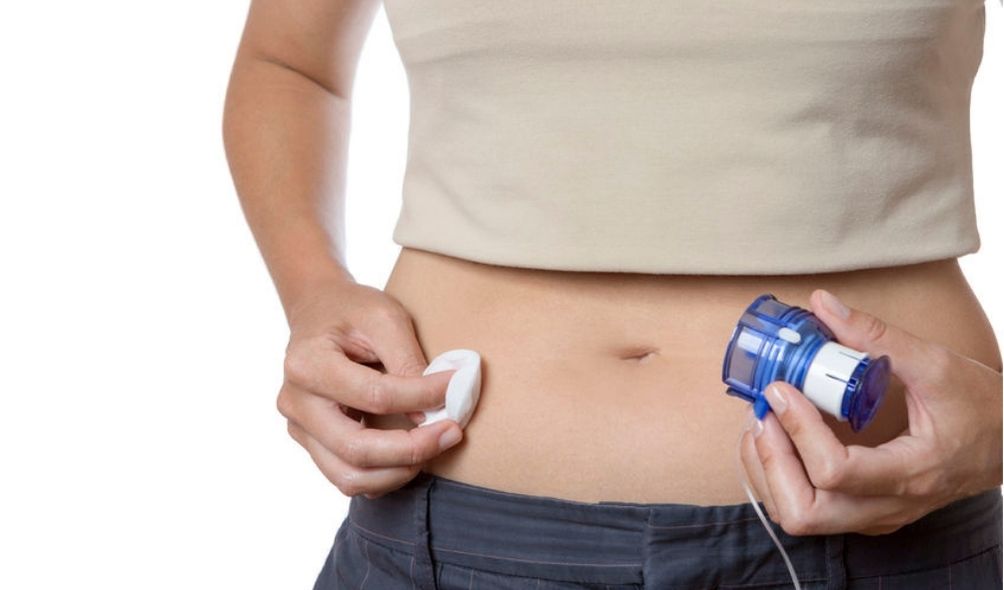 Features Of Insulin Pump